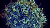 Mavi kısımlar insan hücresi, sarı noktalar HIV virüsü