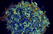 Mavi kısımlar insan hücresi, sarı noktalar HIV virüsü