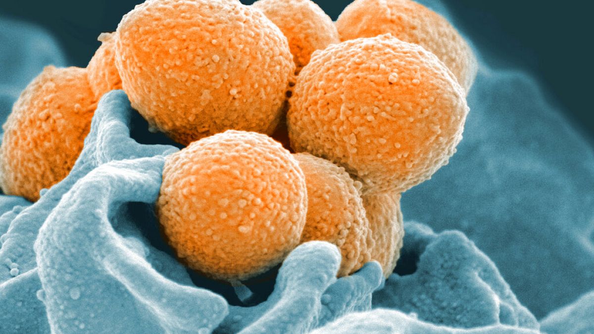ABD Ulusal Alerji ve Bulaşıcı Hastalıklar Enstitüsü tarafından paylaşılan fotoğrafta elektron mikroskobu tarafından çekilen Strep A'nın ilerlemiş hali görülüyor