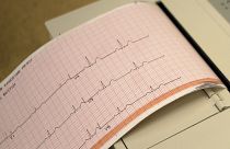  تخطيط كهربية القلب، دراسةٌ أمريكية تكشف أن درجات الحرارة المتطرفة تزيدُ من خطر الوفاة لدى الأشخاص المصابين بأمراض القلب والأوعية الدموية، 12 ديسمبر 2022.