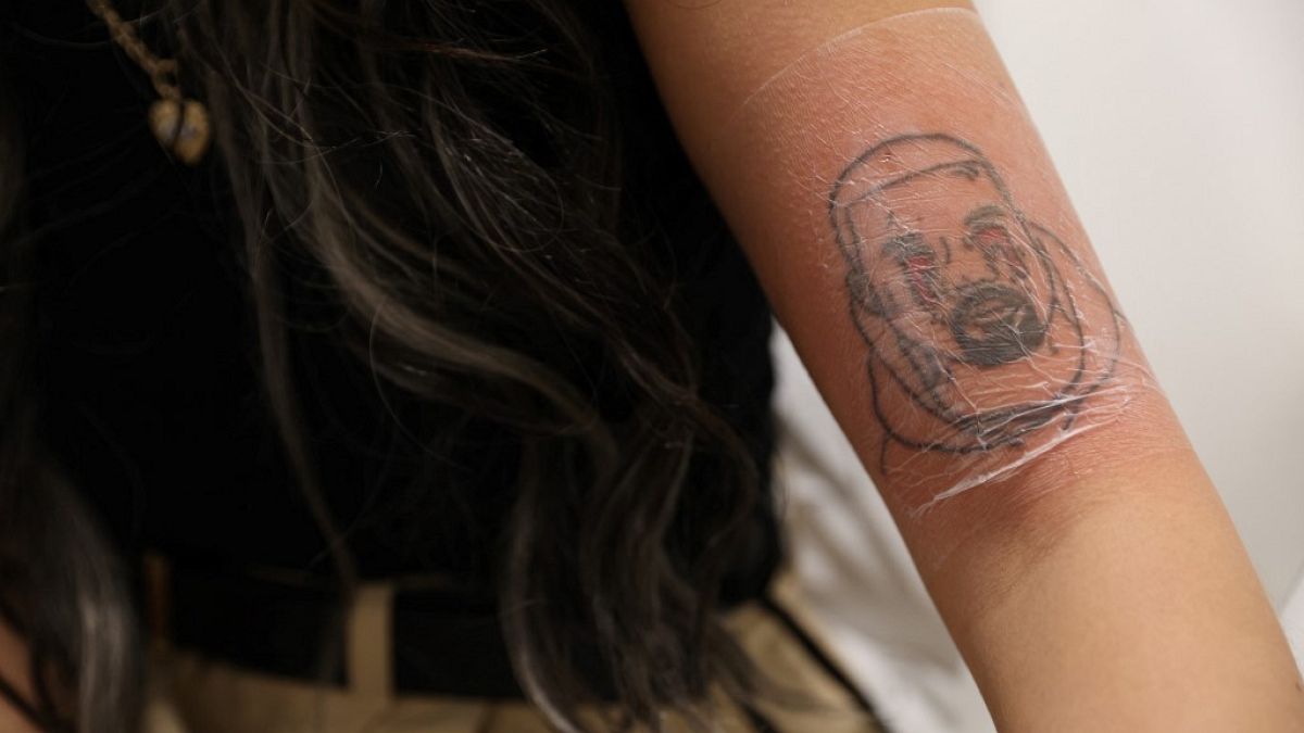 Kimberly Westgarth lässt sich ihr Kanye West Tattoo kostenlos entfernen