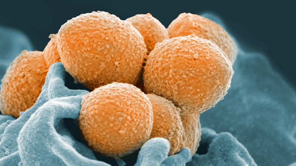 Des scientifiques ont découvert un anticorps clé qui pourrait conduire à de nouveaux traitements contre Strep A
