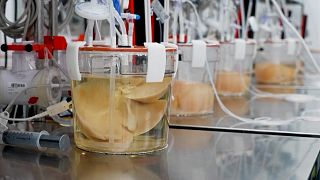 Image shows a pig liver in a jar in a laboratory in Minnesota.