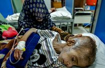 صورة أرشيفية لأم أفغانية تساعد طفلها المصاب بسوء التغذية الحاد والذي يتلقى علاجاً في مستشفى أنديرا غاندي في كابول، أفغانستان، 22 مايو 2022.