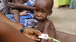 Appel de fonds de l'ONU pour sauver 30 millions d'enfants dénutris