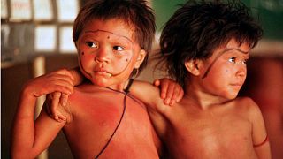 طفلان من اليانومامي/ الأطفال يموتون بسبب أمراض قابلة للشفاء