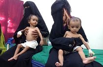 نساء يحملن أطفالهن الذين يعانون من سوء التغذية في مستشفى حيس الريفي في الحديدة، اليمن، 11 أكتوبر/تشرين الأول 2022.