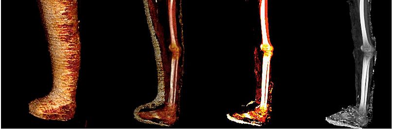 Eski Mısır inanışına göre sandaletler ölünün dirildikten sonra tabuttan çıkarak yürümesi amacıyla giydiriliyor