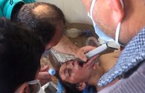 محاولة علاج سوري تأثر بما يُزعم وأنه قصف بالأسلحة الكيماوية