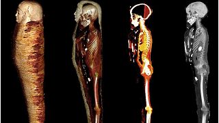 Secrets of 2,300-year-old golden boy mummy revealed by CT scans