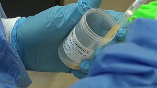 Deadly Marburg Virus outbreak in Equatorial Guinea kills 9