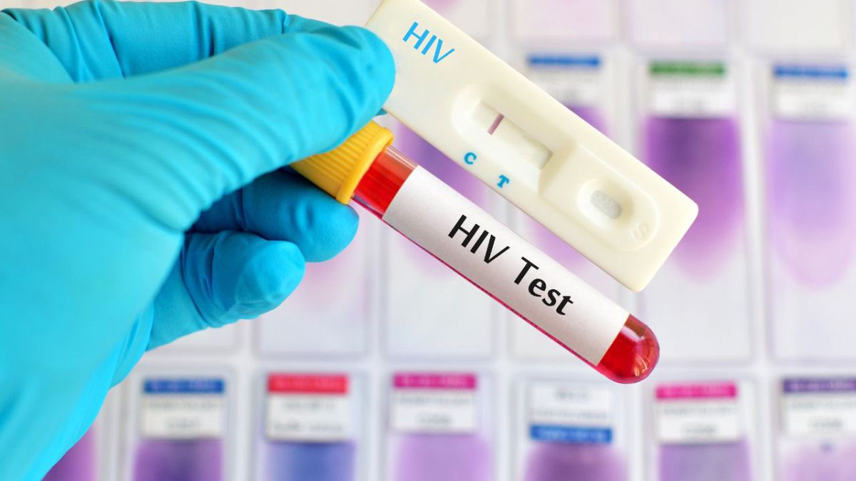Schätzungsweise 40 Millionen Menschen leben weltweit mit mit einer HIV-Infektion