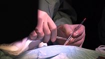 Foetus that died in the womb has its heart donated in transplant first
