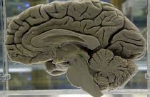 دماغ بشري معروض في معرض لعلوم تشريح الجهاز العصبي في ولاية نيويورك الأميريكية