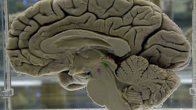 دماغ بشري معروض في معرض لعلوم تشريح الجهاز العصبي في ولاية نيويورك الأميريكية