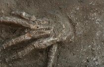 دست بریده کشف شده در مصر