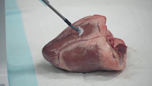 This tiny robot could 3D print inside your body to make repairs and fight cancer