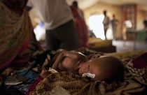 Çad'da yetersiz beslenme sıkıntısı çeken bir bebek