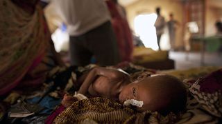 Çad'da yetersiz beslenme sıkıntısı çeken bir bebek