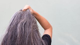 امید دانشمندان به درمان خاکستری شدن موها