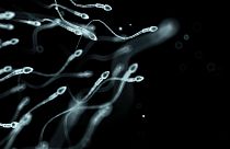 La conta spermatica è drasticamente diminuita negli ultimi decenni 
