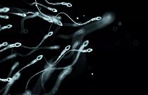 Araştırmacılar sperm hasarına ilişkin en büyük risk faktörlerini tespit etti