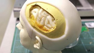 New soft electrodes fan out to allow less invasive brain surgery