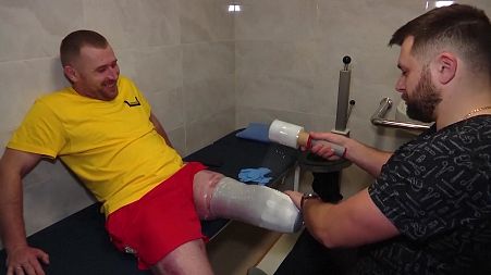 Ukrainian soldiers are being fitted with prosthetic limbs