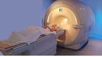 NVision’s “hyperpolarisation” technology uses quantum physics to enhance the magnetic signal of molecules in the human body by up to 100,000 times using standard MRIs.