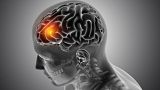 Scientists successfully caused cancer cells to self-destruct in brain tumour treatment breakthrough