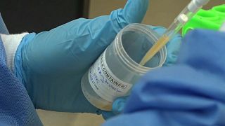 Fin de l'épidémie du virus de Marburg en Guinée équatoriale