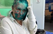  Elena Milashina quelques heures après son agression dans un hôpital de Grozny (Tchétchénie), le 4 juillet 2023.