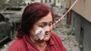 Anna, 76 anni, è ferita dopo un attacco missilistico nella città ucraina occidentale di Leopoli. 6 luglio 2023/AFP