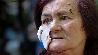 Hanna Fedorenko ficou ferida por um dos mísseis russos que atingiram Lviv