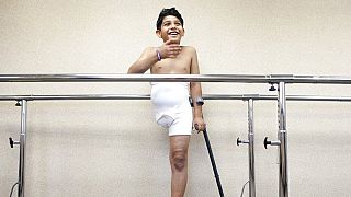 Wednesday, May 1, 2013 a 9-year-old boy in Iraq who lost his right leg in a bombing during the US-invasion. 