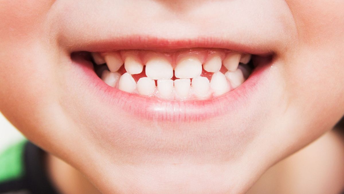 Os cientistas estão a aproximar-se de um medicamento que faz os dentes crescerem de novo