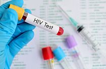 The Geneva patient is the latest person to be considered cured of HIV.