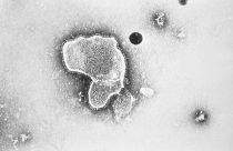 This 1981 electron microscope image provided by the Centers for Disease Control and Prevention shows a human respiratory syncytial virus, also known as RSV.