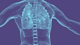 Researchers in the UK have tested a robot tentacle which can reach deep in the lungs to treat cancer.