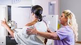A woman gets a mammogram to screen for breast cancer