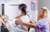 Bir kadın meme kanseri taraması için mamografi çektiriyor