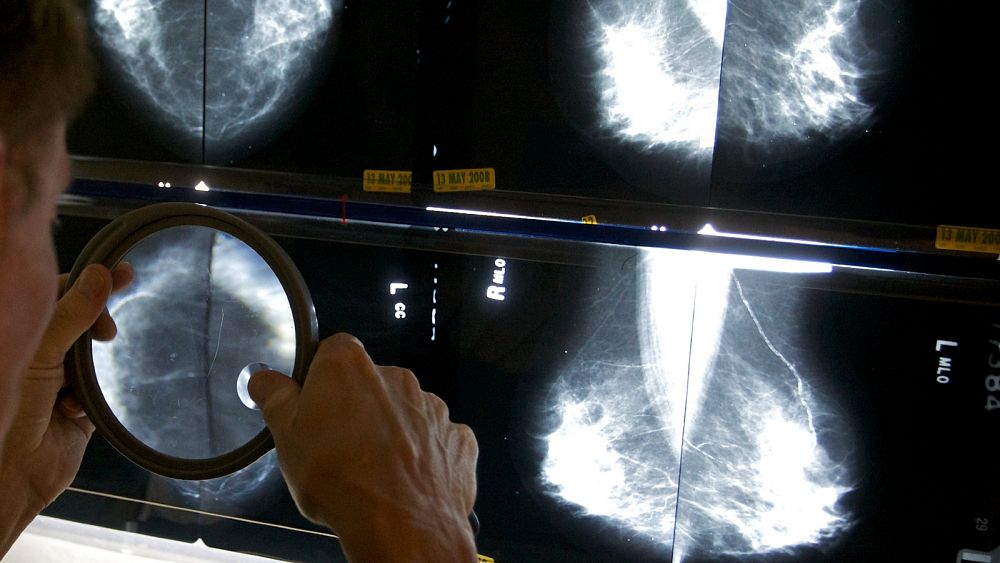 Рентгенолог използва лупа, за да провери мамографиите за рак на