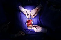 إجراء عملية قلب مفتوح في جوزويه ساليناس سالغادو في المركز الطبي بجامعة ميريلاند في بالتيمور، في 28 نوفمبر 2016