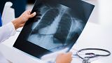 A doctor looks at a chest radiograph.