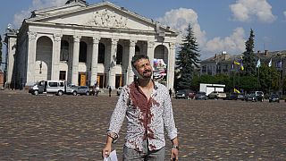 Verletzer Mann vor dem zerstörten Theater in Tschernihiw in der Ukraine