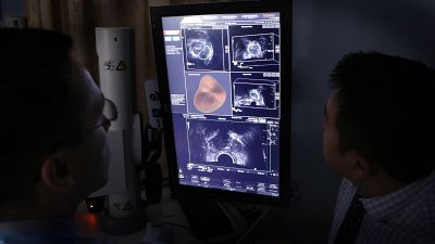 Ultrasound and MRI images are combined to increase accuracy of taking biopsies from the prostate of a patient in California, 2014.
