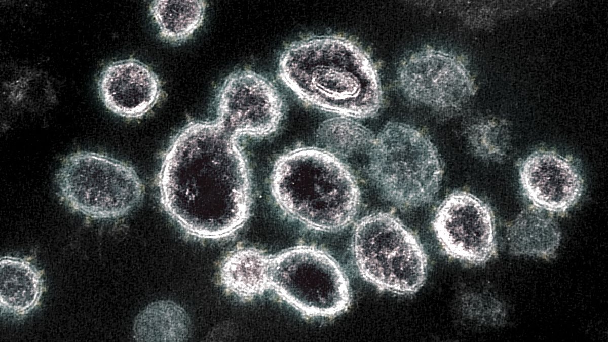 المعهد الوطني للحساسية والأمراض المعدية صورة مجهر إلكتروني لفيروس كورونا.