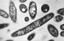 صورة مجهرية لبكتيريا الفيلقية