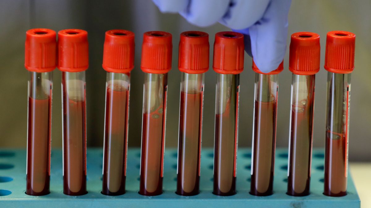 Gönüllülerden alınan kan örnekleri Londra'daki Imperial College laboratuvarında işleniyor