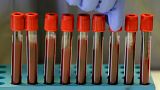 Blood samples from volunteers are handled in the laboratory at Imperial College in London